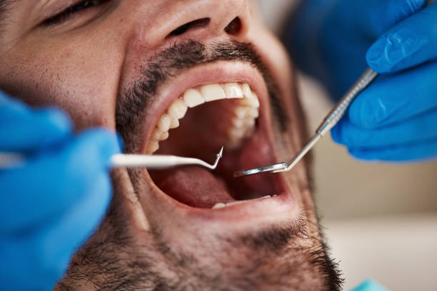Best Broken or Chipped Tooth Repair in Ketchikan, AK
